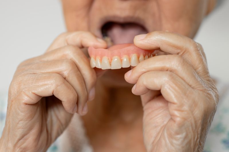 Why Dentures Are Important — And What Happens When You Live Without Them